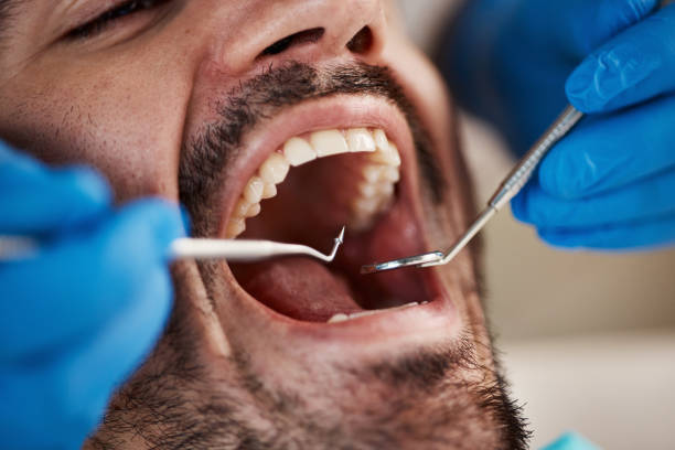 Best Emergency Dental Care for Sports Injuries in River Road, NC